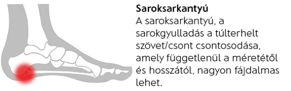 Saroksarkantyú